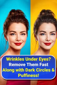 get rid of wrinkles under eyes